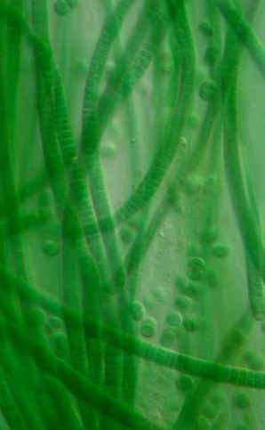 Cyanobacteria cells